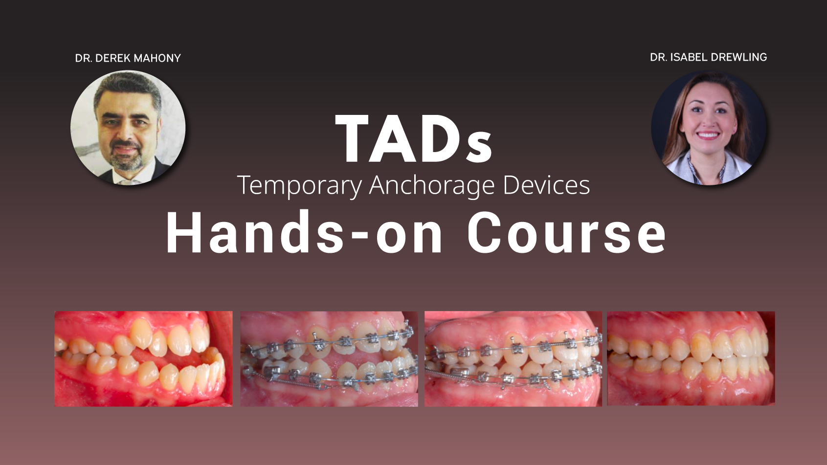 TADs Hands-on Course – Dr. Derek Mahony