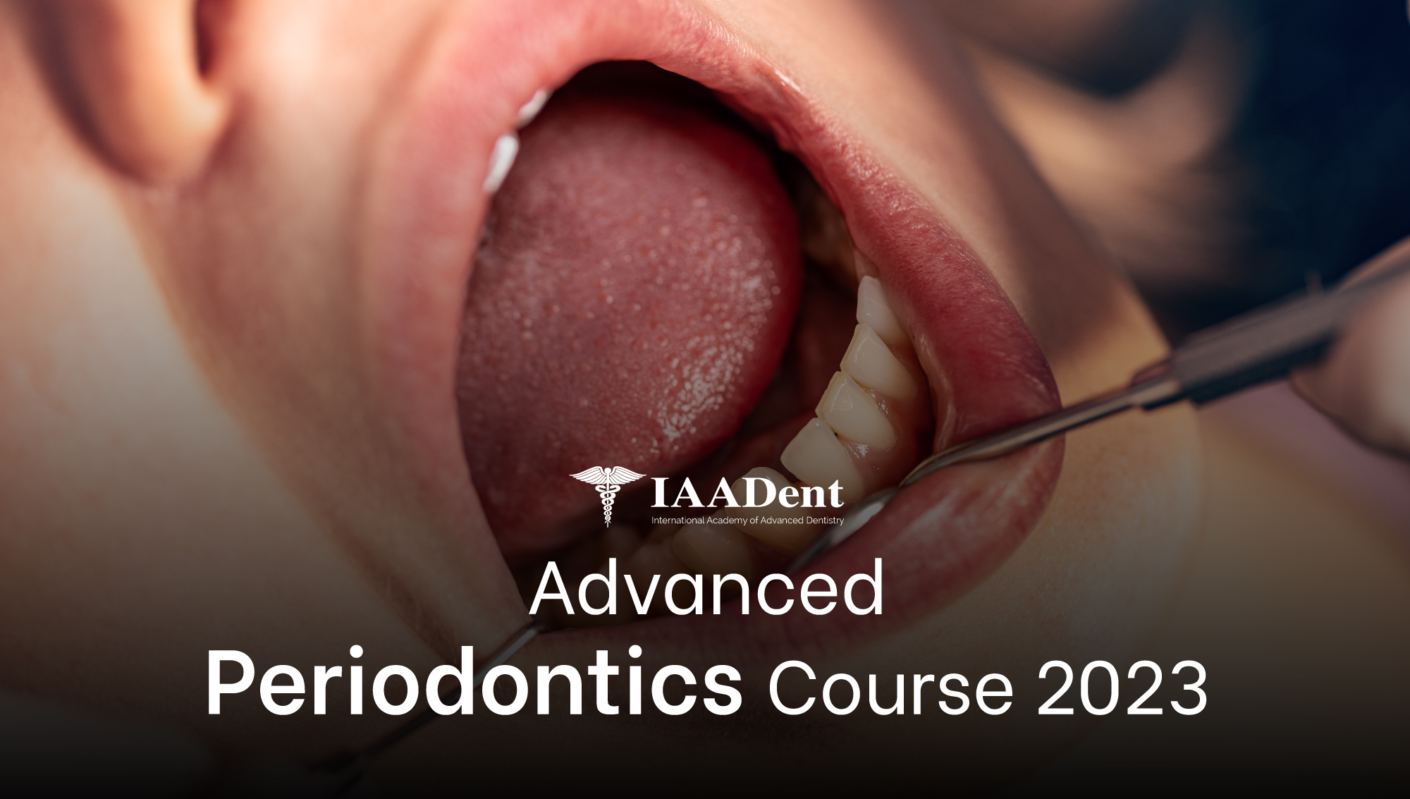 IAADent Advanced Periodontic Course 2023 wiht MINIMAX IMPLANT