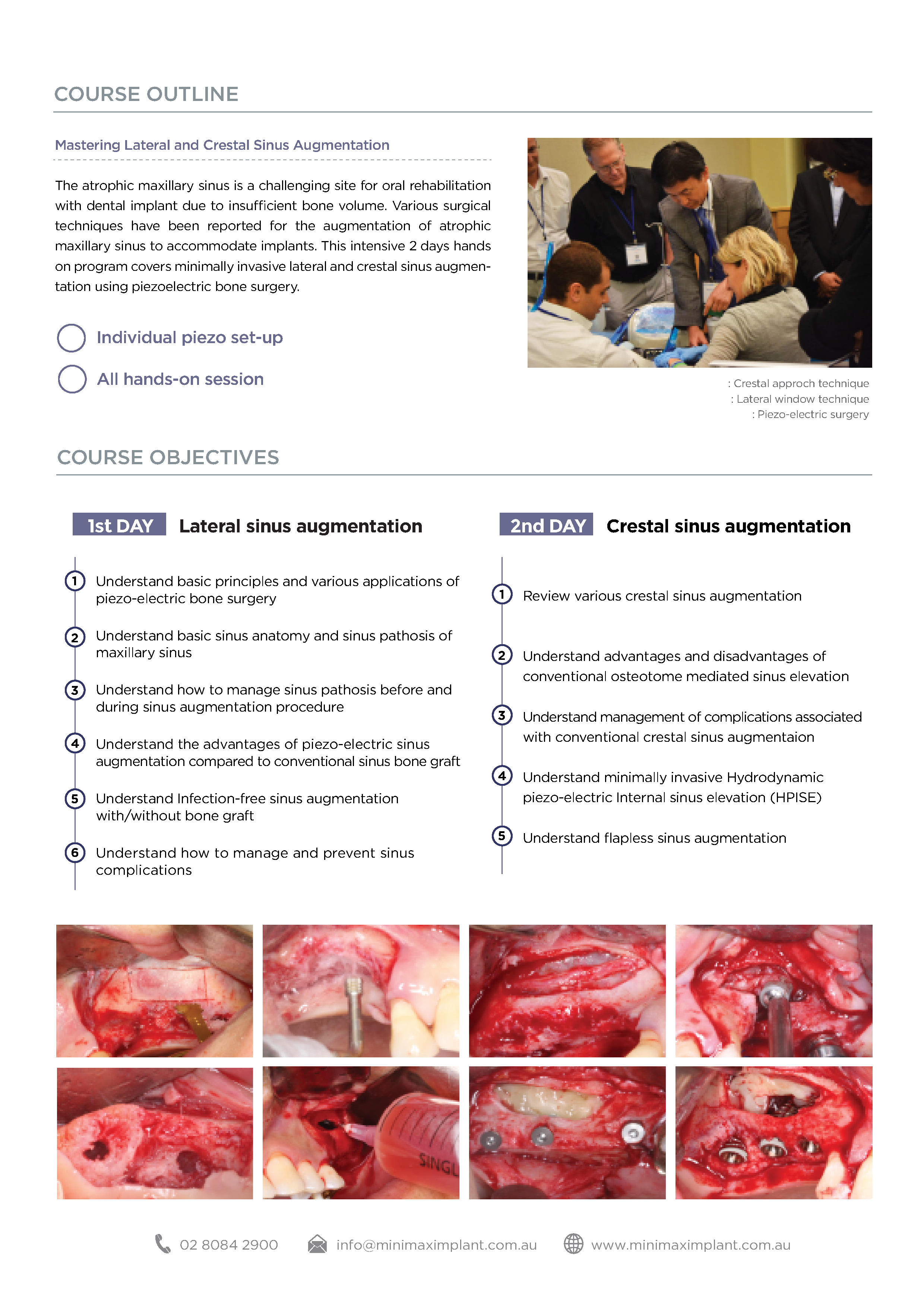 2020 Piezoelectric Sinus surgery & Autologous Sticky Augmentation procedure-3