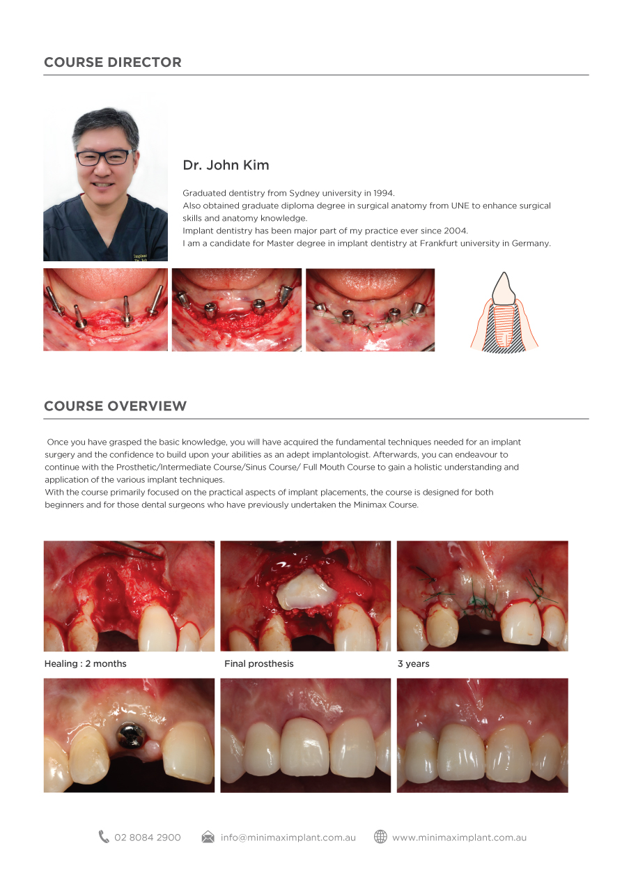 [30-31 AUGUST 2019] DENTAL IMPLANT INTENSIVE COURSE IN MELBOURNE-2