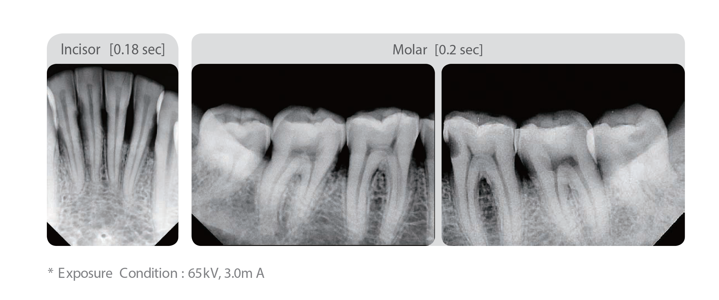 EZRAY_FOCAL SPOT_SMART FUNCIONS-04