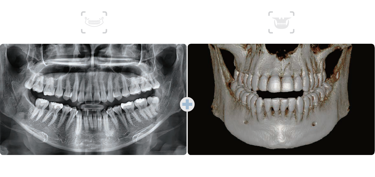 digital dental x rays