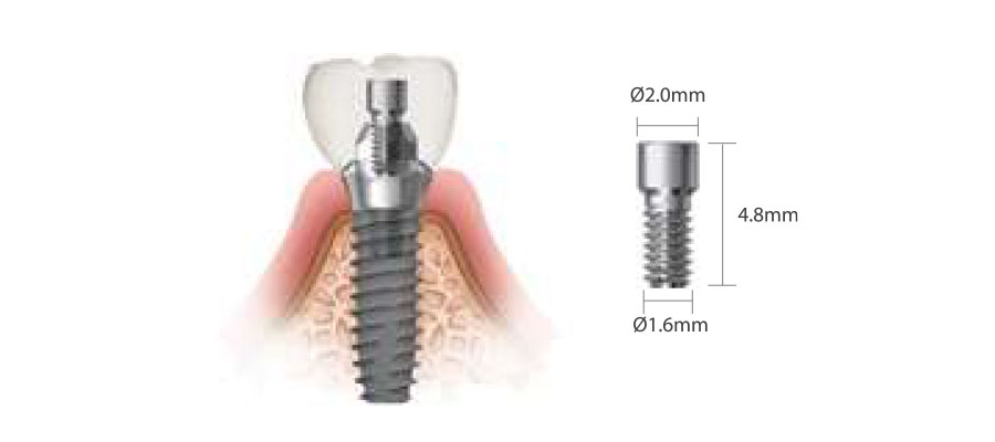 simpleline-dentium-minimax-implant-900x400-03