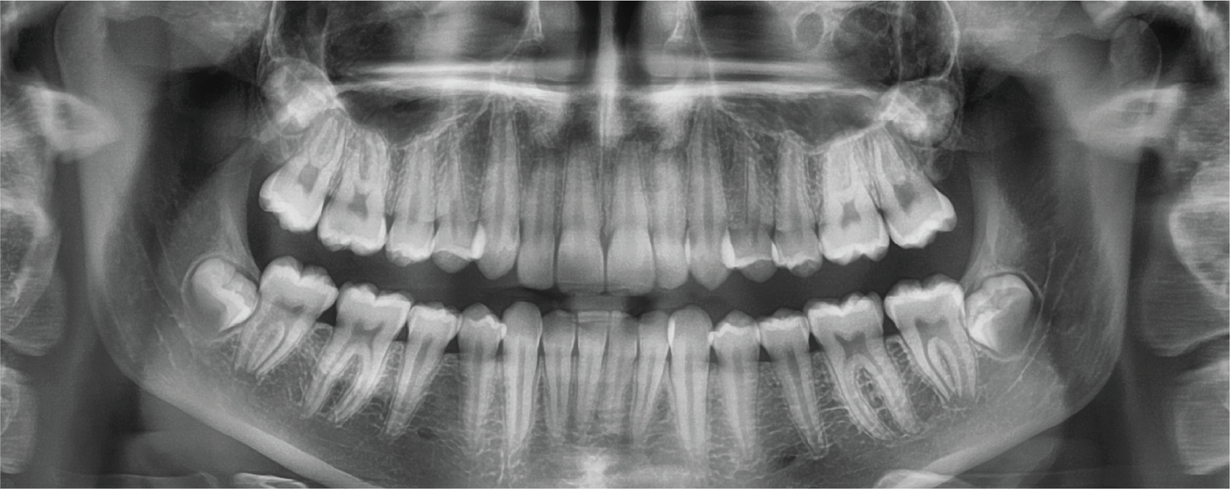 x_ray-PaX-i-2D-Imaging _Systems-vatech-minimax