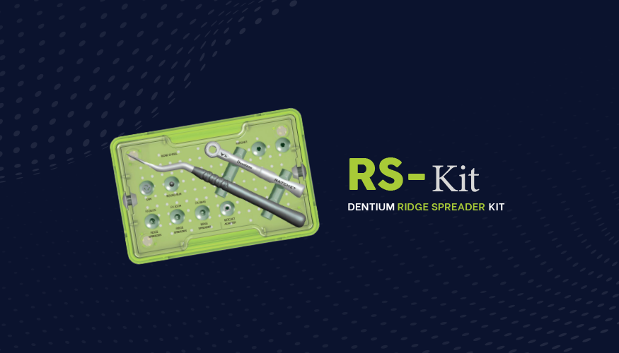 RidRidge Spreader (RS) Kit