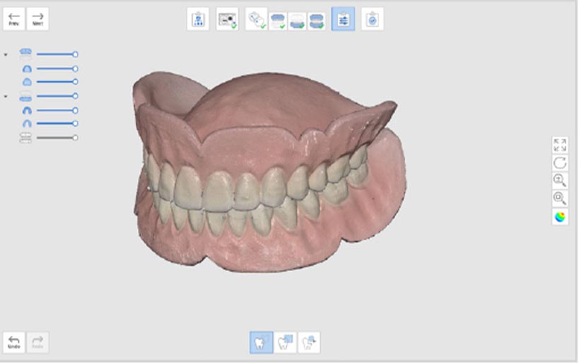 Replica denture