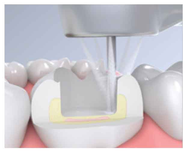 Optimum Cooling of Four Sides