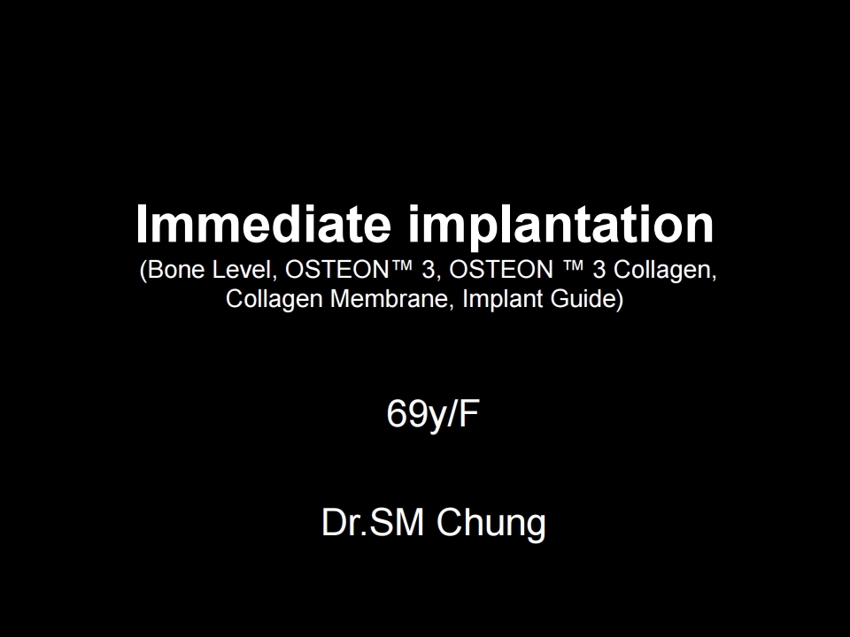 Immediate implantation with Dentium Regeneration