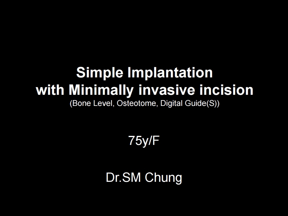 Simple Implantation with Minimally invasive incision