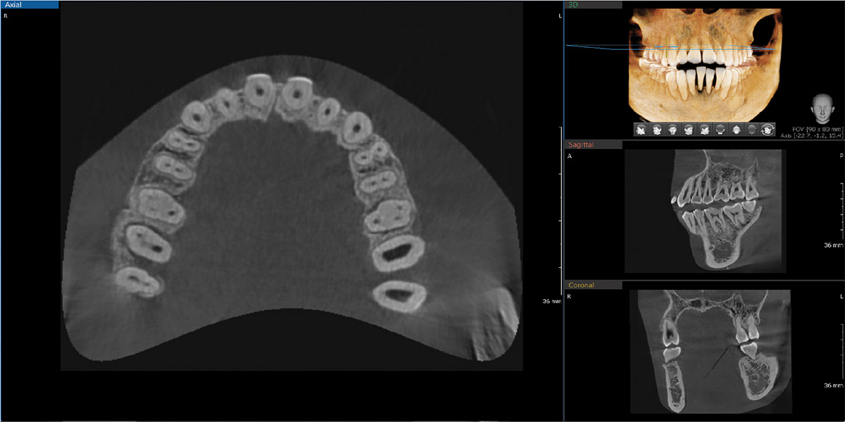 INTEGRAL FOV FOR 3D IMAGE