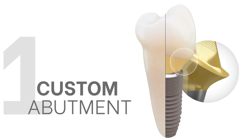 Maxfit (Custom Abutment)-1